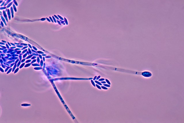 ニンニク 栽培 枯れる原因11つ 菌 ウィルス 病気 植物の秘島